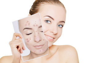 Zmiany skórne? Niepokojące znamiona? Koniecznie udaj się do dermatologa
