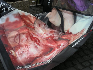 Nie dla aborcji - pikietowali w Radomiu